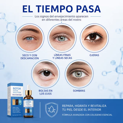 Botox Solution - ¡Más joven en pocos días!